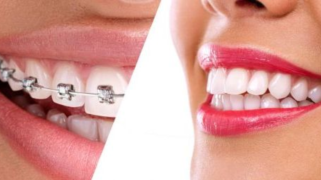 Amikor akasztják a hóhért...3.rész