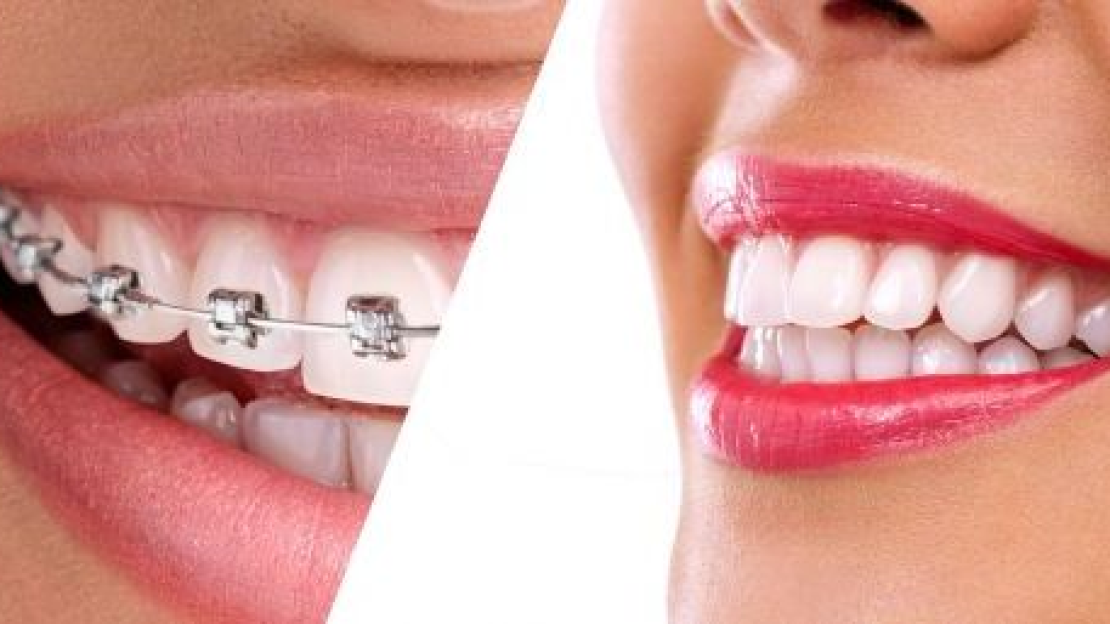 Amikor akasztják a hóhért...2.rész