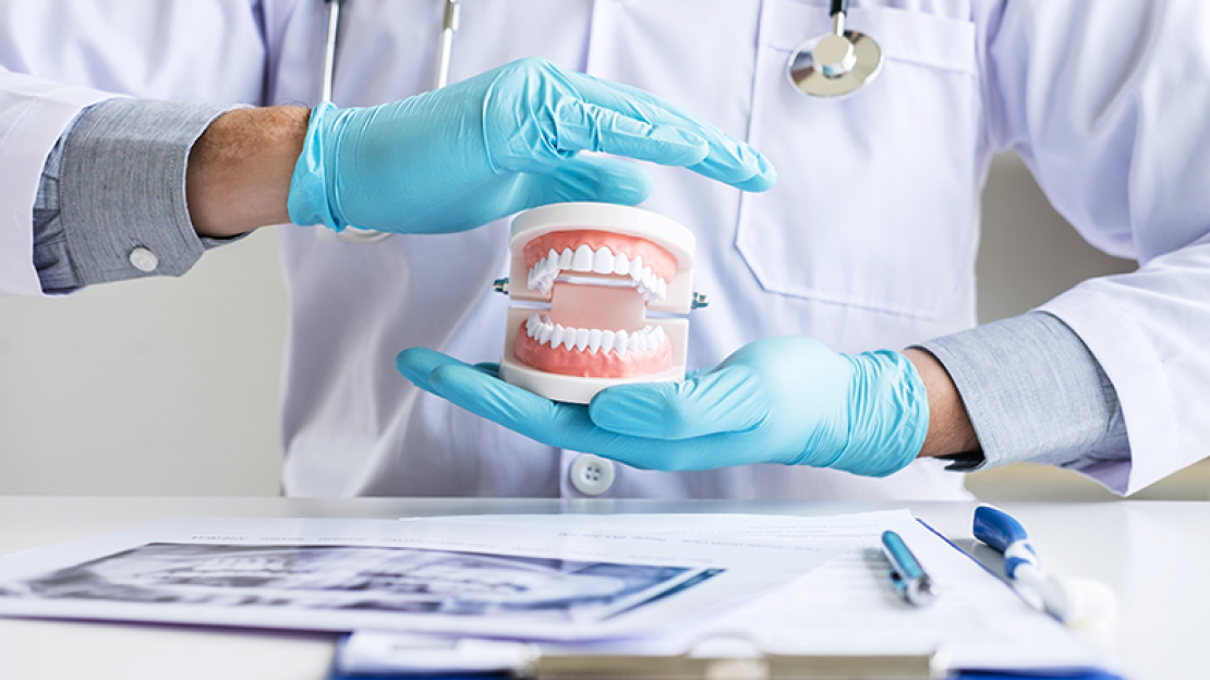 Fogpótlás árak, avagy mi határozza meg annak mértékét?