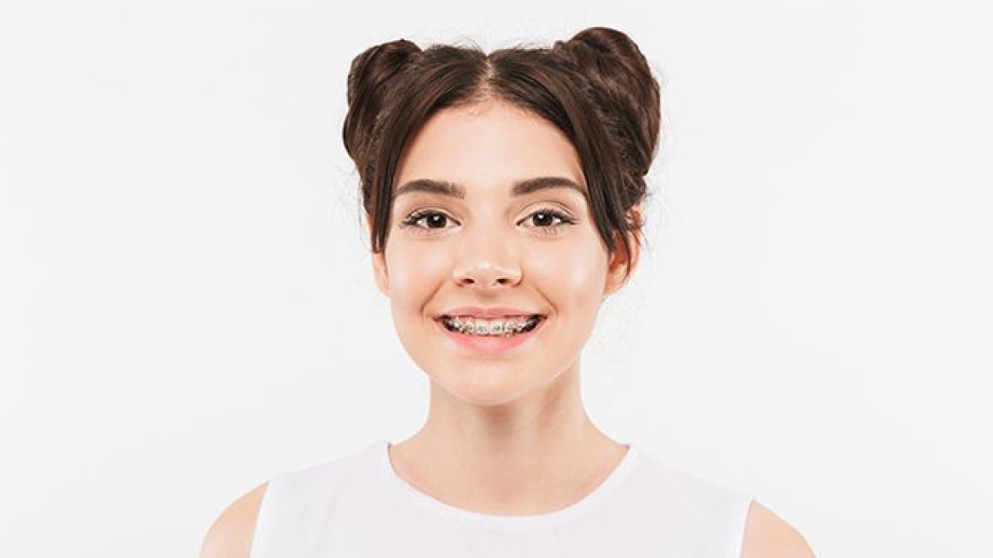 Mitől olyan forradalmi a Damon Clear fogszabályozó?