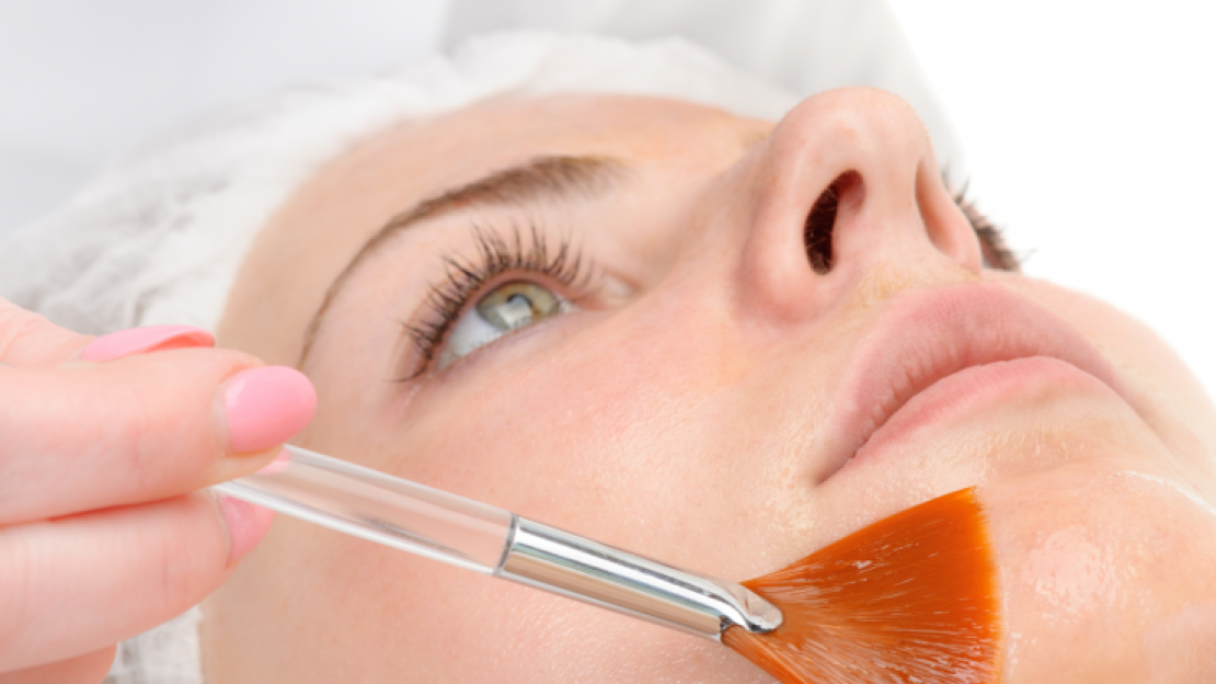 TCA vagy gyümölcssavas hámlasztás, hogyan válasszunk?