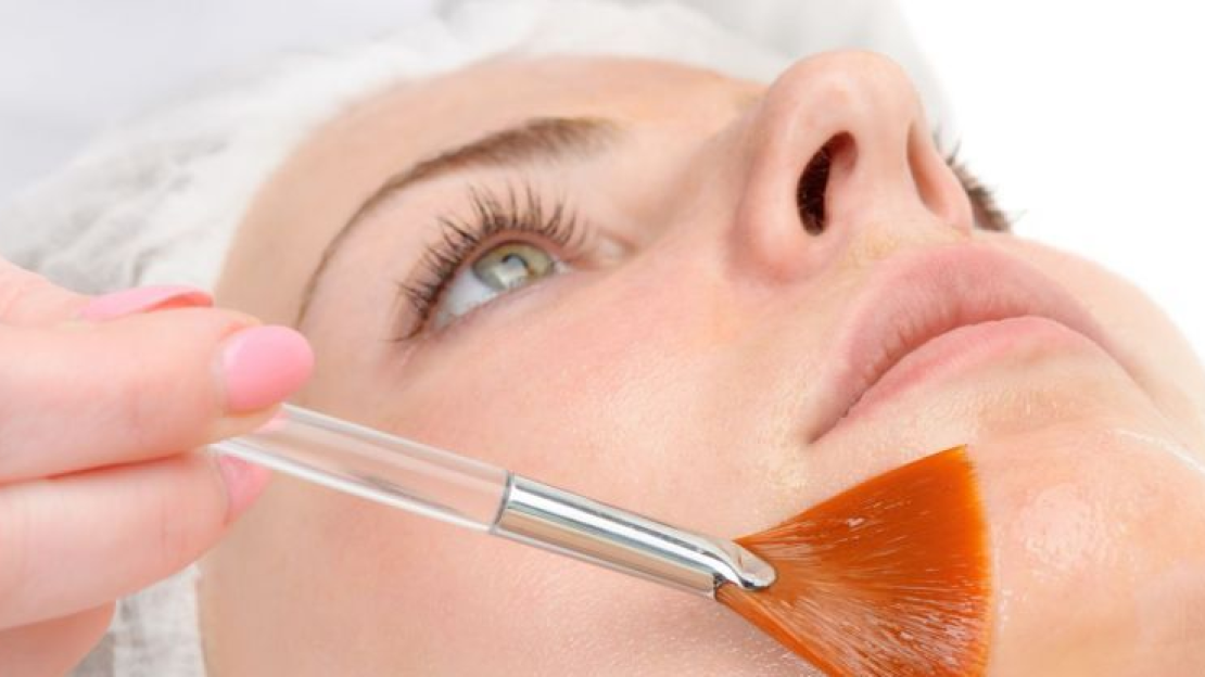 Milyen bőrhibákra ajánlott a savas hámlasztás?