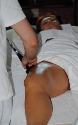 Rádiófrekvenciás kezelés karcsúsítás