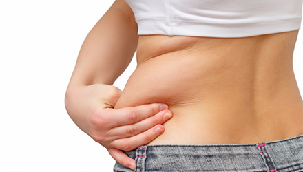 rádiófrekvenciás zsírbontás könnyedén fájdalom nélkül