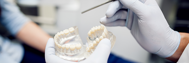 cirkónium korona ár mitől függ