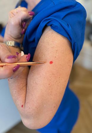 Ízületi derm pont Dermal piercing