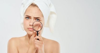 Kozmetikai megoldások pattanások ellen
